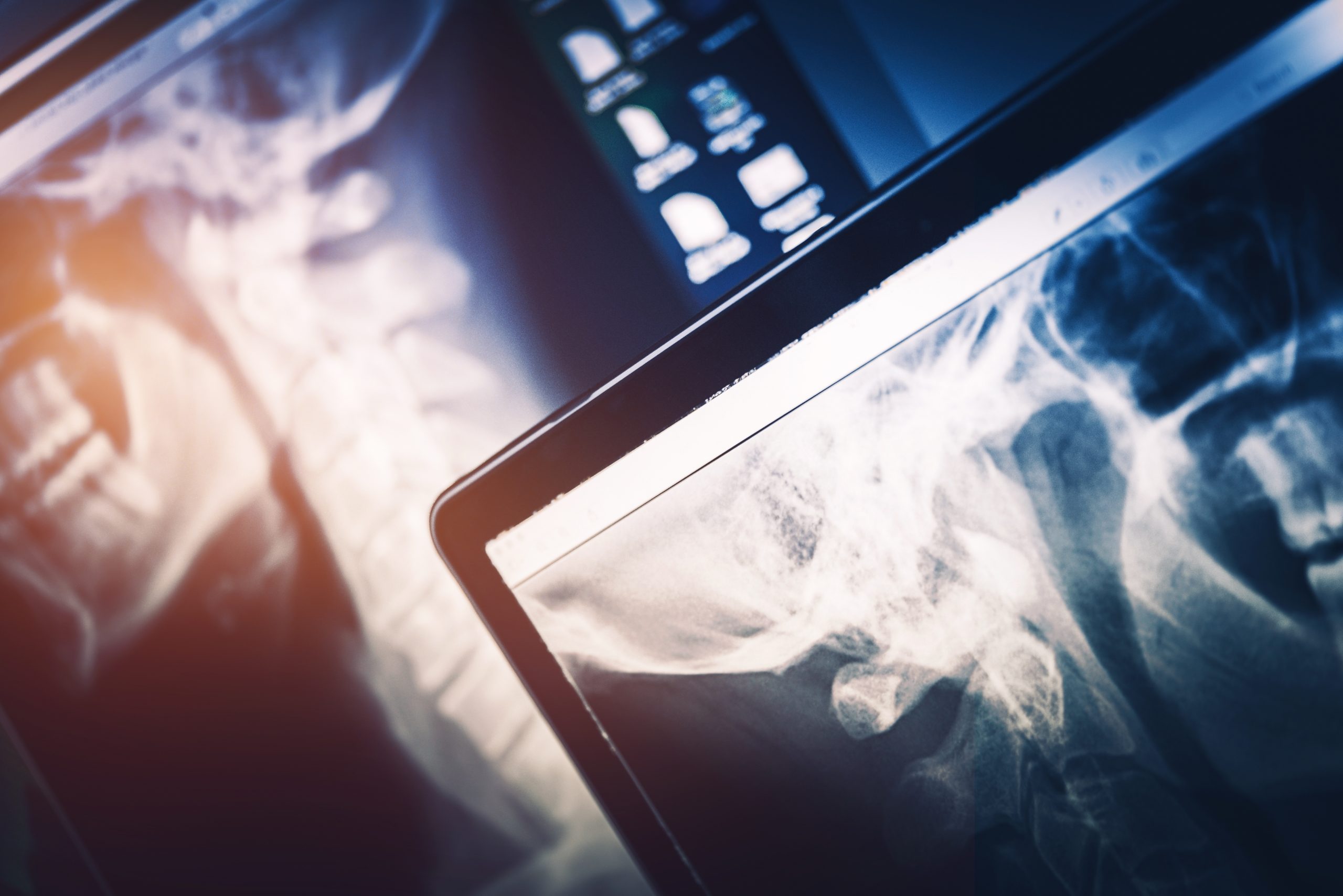 Breakthrough in medical device imaging subassembly